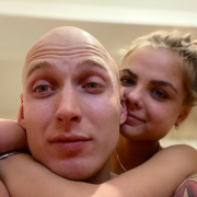 Bald_brother_