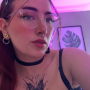 freckles_