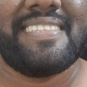 lankanblackyguy