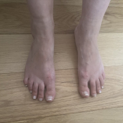 FabFeet81