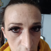 Alexis_Lee