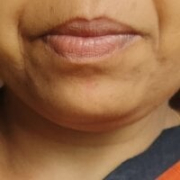 PRlYA28