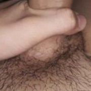 Ciruelo1