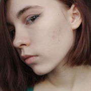 MaryDavise