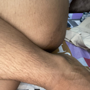 gunni-34